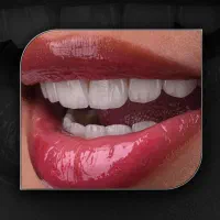 کامپوزیت لیرینگ اقساط اثر یک هنرمند