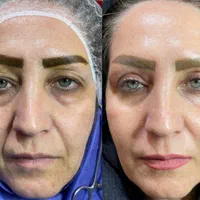 جراحی‌های زیبایی توسط متخصص در بیمارستان قم|خدمات آرایشگری و زیبایی|قم, بلوار امین و ساحلی|دیوار