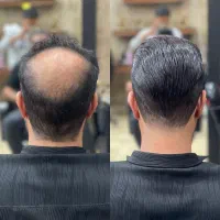 تعویض چسب،خدمات پروتزمودر منزل و محل کارشما|خدمات آرایشگری و زیبایی|تهران, فلسطین (میدان انقلاب)|دیوار