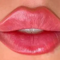 آموزش ژل بوتاکس نخ مزولیفت پی آرپی لیزرآنزیم پزشک|خدمات آموزشی|کرج, گوهردشت|دیوار