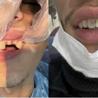 انجام کلیه خدمات دندانپزشکی قرارداد بانک سپه ورفاه|خدمات آرایشگری و زیبایی|فلاورجان, |دیوار