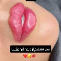 ژل فیلر  زاویه سازی لیفت هایفو بلفارو مزو آنزیم|خدمات آرایشگری و زیبایی|مشهد, هفت تیر (حافظ)|دیوار