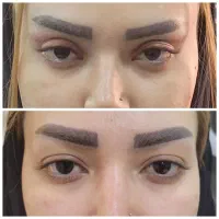 عمل جراحی پلک (بلفاروپلاستی)|خدمات آرایشگری و زیبایی|اصفهان, مسجد مصلی|دیوار