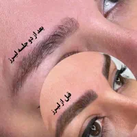 ریمو تتو ابرو بادستگاه