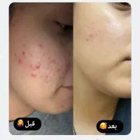 کرم ترمیم کننده گاتیو|آرایشی، بهداشتی، درمانی|شبستر, |دیوار