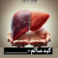 پاک سازی کبد چرب|آرایشی، بهداشتی، درمانی|گنبد کاووس, |دیوار