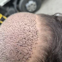 استخدام خانم  برداشت کار