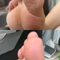 پدیکور کفسابی ۳۵۰