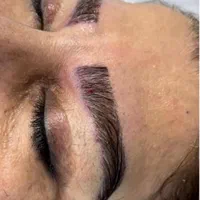 کاشت مو ، ریش ، ابرو|خدمات آرایشگری و زیبایی|شیراز, معالی‌آباد|دیوار