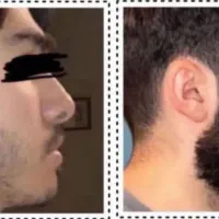 تار تار ریشات در میارم