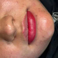 ترمیم رایگان
