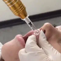 آموزش ژل بدون سوزن با دستگاه