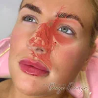 دوره آموزش بوتاکس/ژل/نخ/مزو نقد و اقساط|خدمات آموزشی|کرمانشاه, |دیوار