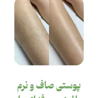 لیزر موزاید خانمها وآقایان شاتی ورولی450 هزارتومان|خدمات آرایشگری و زیبایی|تهران, فردوس|دیوار