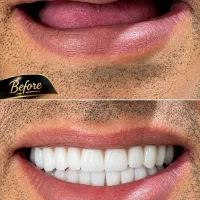 دندان مصنوعی تخصص ماست..