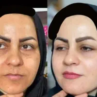مشاور نمایندگی محصولات لاکچری کوین،ویتابلا