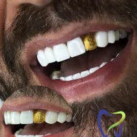 جشنواره بهاری کامپوزیت پالیش بلیچینگ باافرویژه