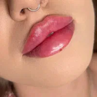 بوتاکس مصپورت۷۵۰ دو نفر معرفی کن نفر سوم نیم بها