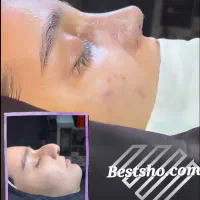 جراحی عمل بینی لیپو ابدو لیفت پروتز پیکرتراشی|خدمات آرایشگری و زیبایی|تهران, تهران پارس|دیوار