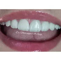دندانپزشکی زیبایی و لمینت