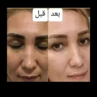 کرم چند کاره درخشان کاملا انحصاری و بدون بازگشت|حراج|خرمآباد, |دیوار