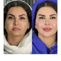 جشنواره تا4شنبه)هایفو گلدفقط1/950با20خدمات رایگان