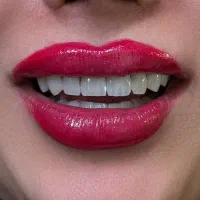 دندان‌پزشکی.لمینت.کامپوزیت