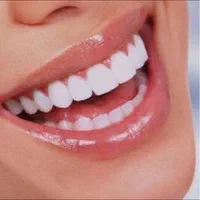 جشنواره خدمات دندانپزشکی(کامپوزیت،لمینت،عصبکشی،|خدمات آرایشگری و زیبایی|شیراز, فرهنگ شهر|دیوار