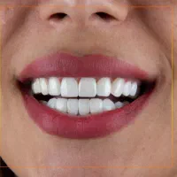 آموزش دندانسازی وکامپوزیت|خدمات آموزشی|ناغان, |دیوار