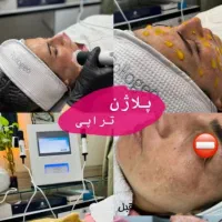 پوست زیبایی درخشش