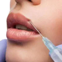 مدل برای تزریق فیلر و بوتاکس توسط پزشک