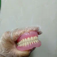 دندان متحرک در سنندج|خدمات آرایشگری و زیبایی|اسدآباد, |دیوار