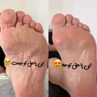 پدیکور درمانی مانیکور پارافین دست وپا