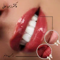خدمات تخصصی آرایش دائم صورت وپاک کردن تتو|خدمات آرایشگری و زیبایی|تهران, مشیریه|دیوار