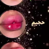 جشنواره فیلر لب  کانتورینگ ژل بوتاکس هایفوتراپی