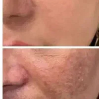 ضد لک وسفید کننده قوی