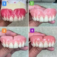 دندانسازی ساخت دندان مصنوعی متحرک باضمانت|آرایشی، بهداشتی، درمانی|مشکیندشت, |دیوار