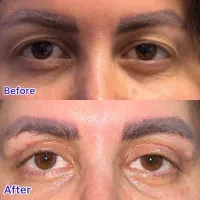 عمل پلک لیفت ابرو سانترال لب تخفیف ویژه|خدمات آرایشگری و زیبایی|تهران, باغ فیض|دیوار