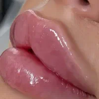 تعدادی مدل برای تزریق فیلر نیاز داریم
