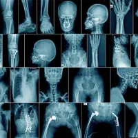 خریدضایعات عکس رادیو لوژی  /نقد /تا 500 کیلو