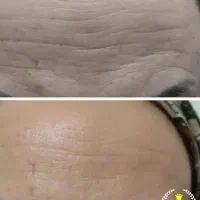 کرم لیفتینگ گاتیو|آرایشی، بهداشتی، درمانی|کرج, شهرک رضوانیه|دیوار