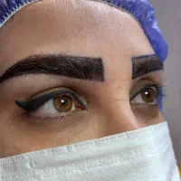 کاشت ابرو / کاشت نچرال