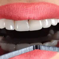 جرمگیری و کامپوزیت|خدمات آرایشگری و زیبایی|تهران, شهرک پرواز|دیوار