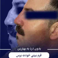اقساط،لیفت بایوفیس صورت مزوژل بوتاکس اصلاح بینی نخ|خدمات زیبایی و سلامت|مشهد, احمدآباد|دیوار