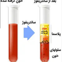 prp پی ارپی مو صورت... مطب دکتر صادقیه|خدمات آرایشگری و زیبایی|تهران, فردوس|دیوار
