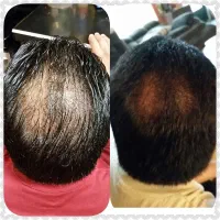 به قرآن کریم این آخرین روش برای موهاته
