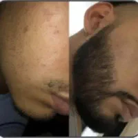 توام میخوای ریش داشته باشی