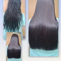 صافی دائم،فر دائم باسوپرکویل احیای مواسیب دیده وفر