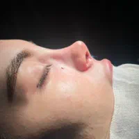 جراحی و عمل زیبایی بینی ( رینو پلاستی )|خدمات آرایشگری و زیبایی|کرج, گوهردشت|دیوار