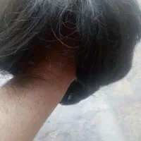 کلاه گیس یا پوستیژ مردانه اصل